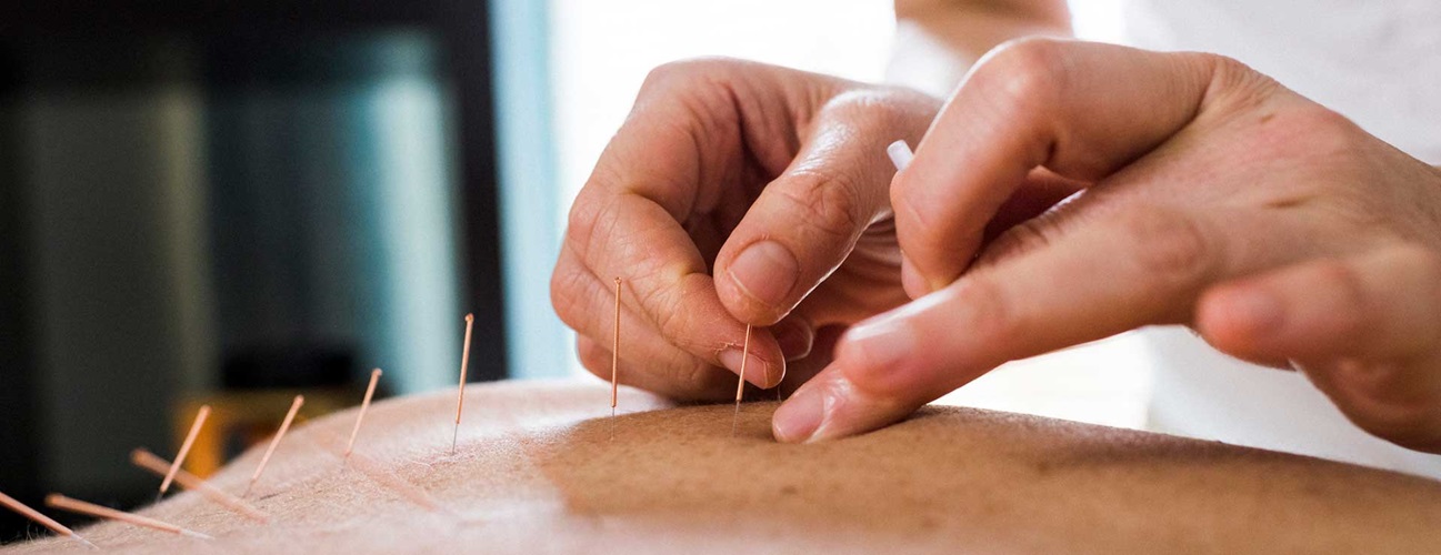 acupuncture hero